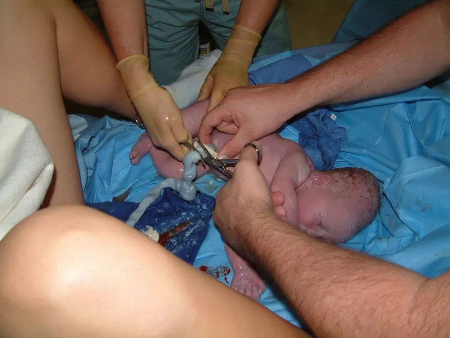 לידה בבית לעומת לידה בבית חולים